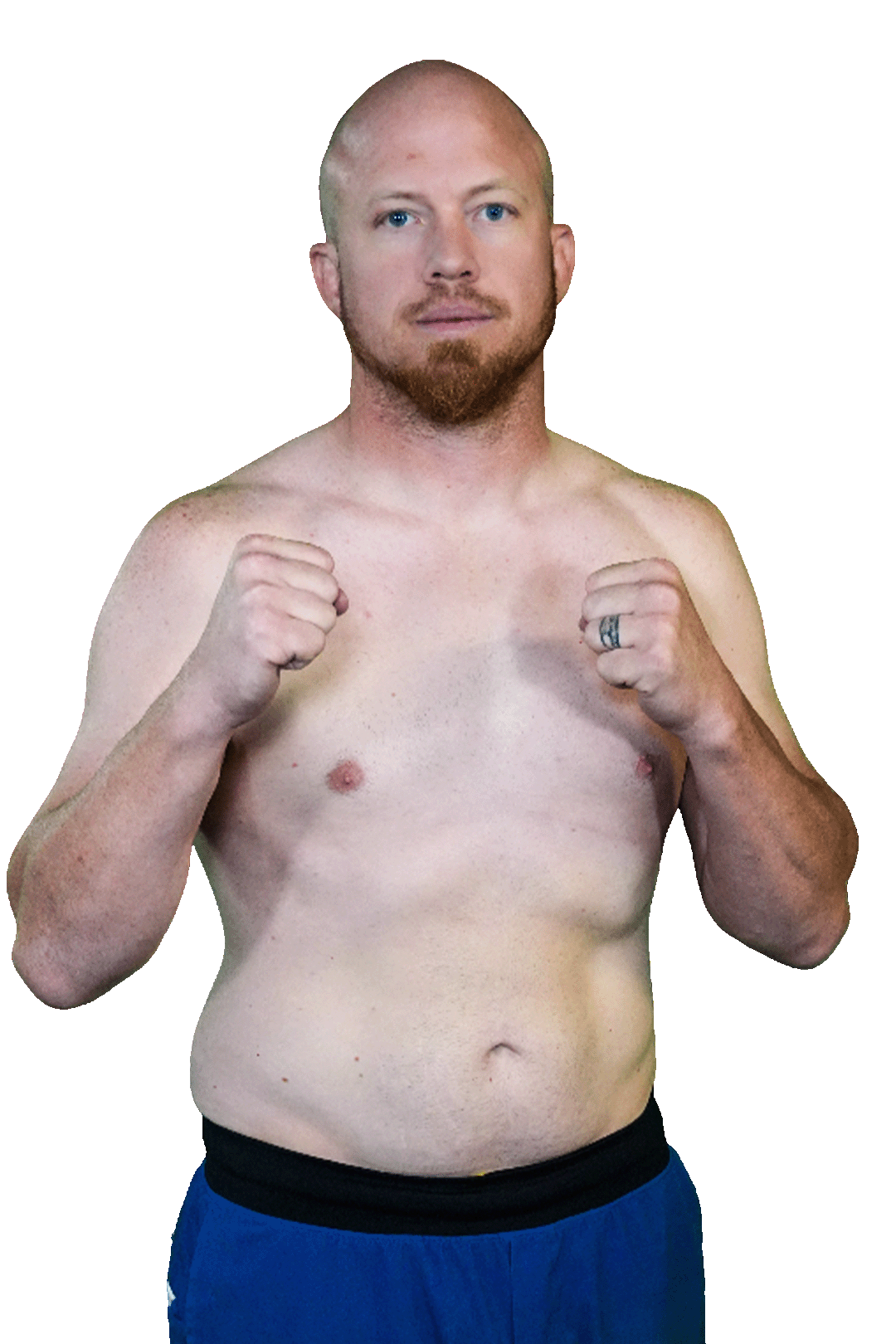 Zack Partridge